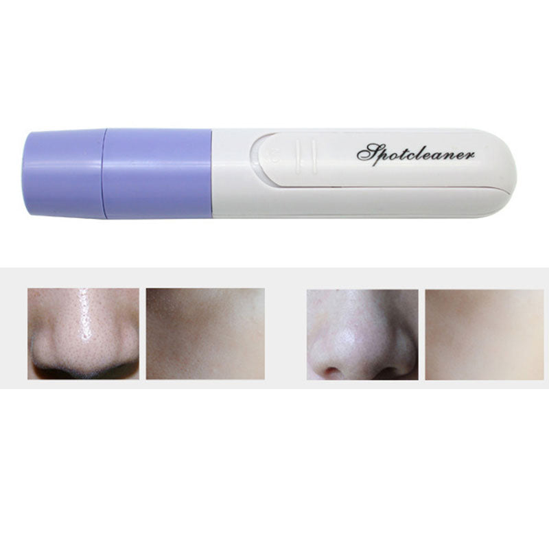 Electric Pore Cleanser and Face Massager
