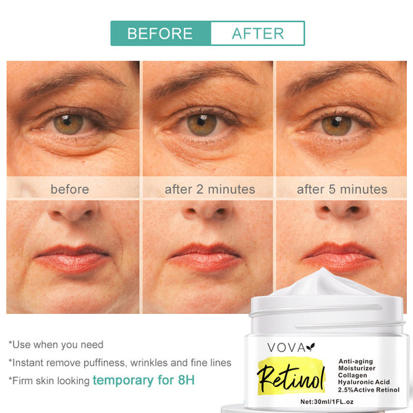 Retinol Moisturiser 30ml